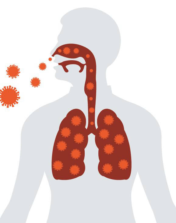 Legionella: prevenire è meglio che curare 1 contaminazione